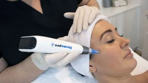 istanbul dermapen tedavisi