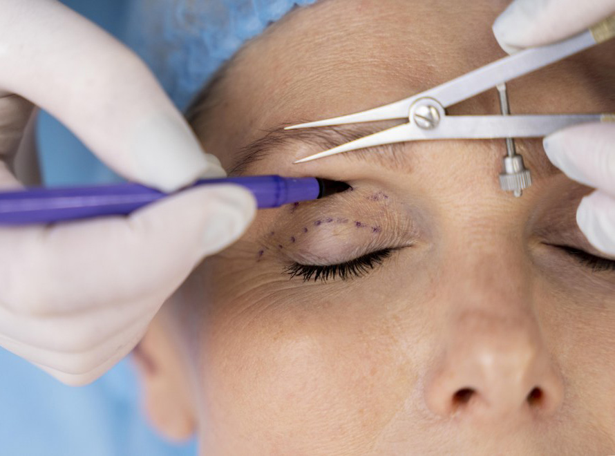 Ksantelazma Tedavisi 1 ksantelazma tedavisi istanbul